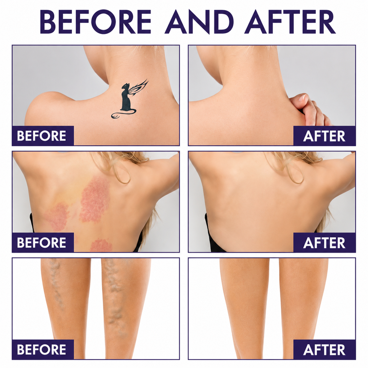 BareLuxe™ Body Perfector | Flawless-Looking Skin & Long-Lasting Coverage