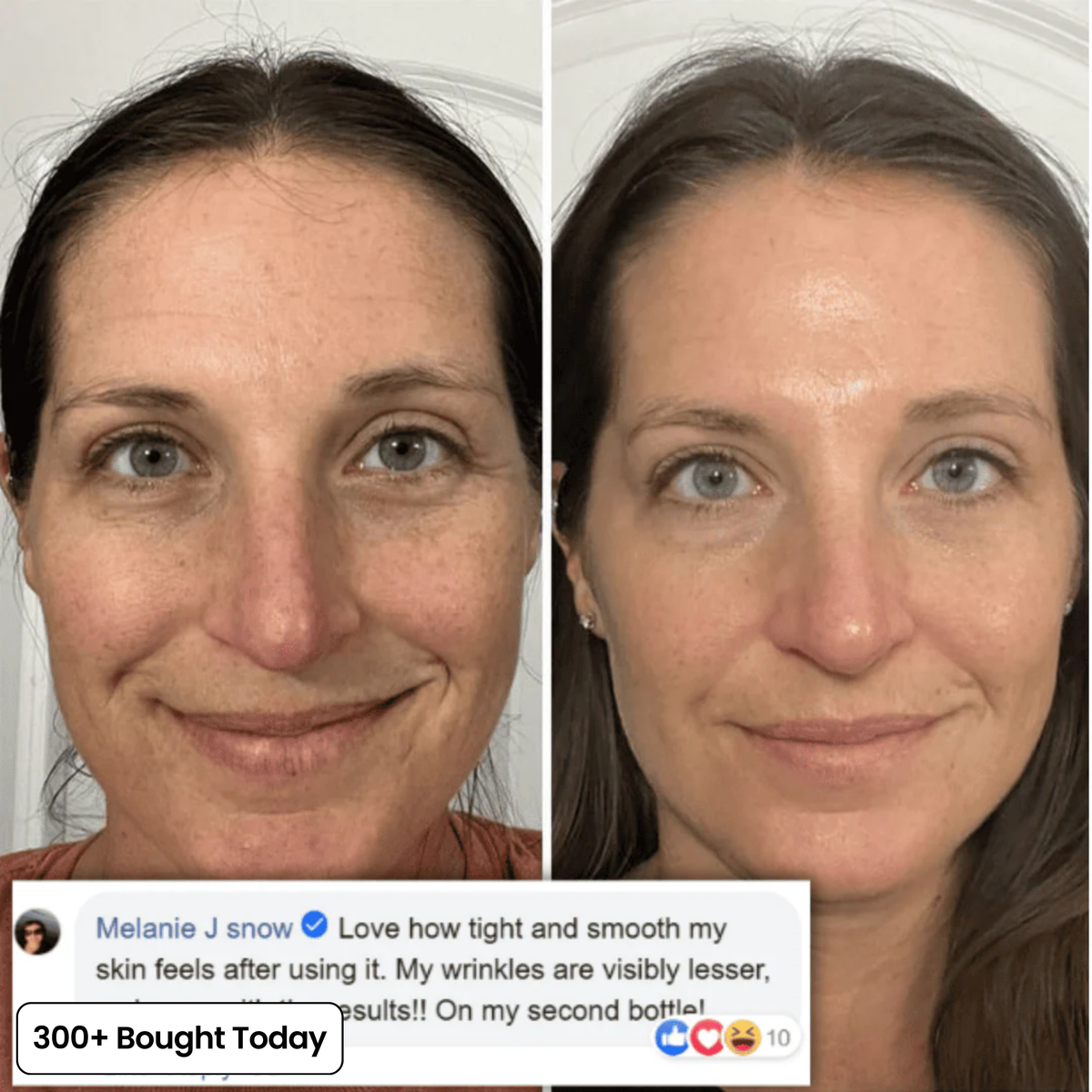 Voluvia™ – Nourishing Volufiline Balm for Plump-Looking Skin