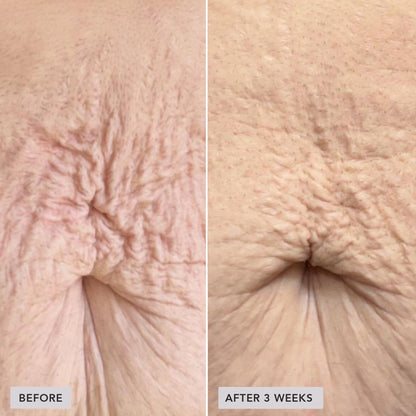 Contourelle™ – Firming body care for a refined silhouette